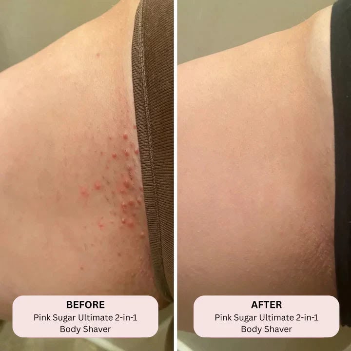 THE ULTIMATE BIKINI TRIMMER - velozah